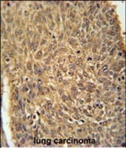 Invitrogen ATG13 Polyclonal Antibody 400 &mu;L; Unconjugated:Antibodies,