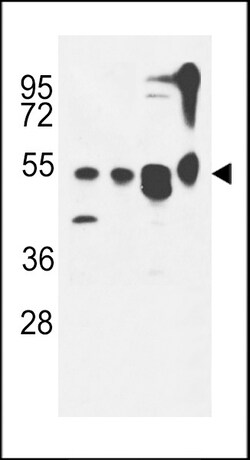 Invitrogen ATG13 Polyclonal Antibody 400 &mu;L; Unconjugated:Antibodies,