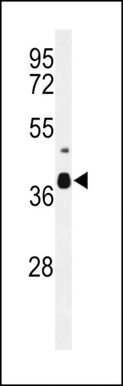 Invitrogen DIPK2A Polyclonal Antibody 400 &mu;L; Unconjugated:Antibodies,