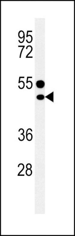 Invitrogen CD1e Polyclonal Antibody 400 &mu;L; Unconjugated:Antibodies,