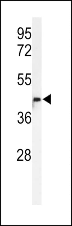 Invitrogen METTL17 Polyclonal Antibody 400 &mu;L; Unconjugated:Antibodies,