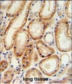 Invitrogen GALNT5 Polyclonal Antibody 400 &mu;L; Unconjugated:Antibodies,