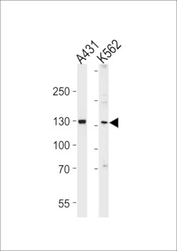 Invitrogen GALNT5 Polyclonal Antibody 400 &mu;L; Unconjugated:Antibodies,