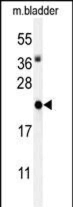 Invitrogen&trade;&nbsp;ID4 Polyclonal Antibody
