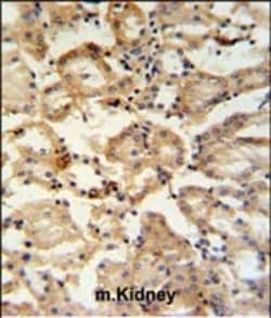 Invitrogen RHBG Polyclonal Antibody 400 &mu;L; Unconjugated:Antibodies,