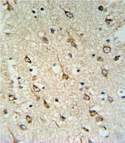 Invitrogen DNAJC6 Polyclonal Antibody 400 &mu;L | Buy Online | Invitrogen&trade; | Fisher Scientific