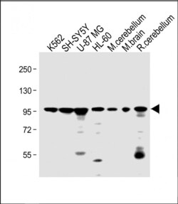 Invitrogen DNAJC6 Polyclonal Antibody 400 &mu;L | Buy Online | Invitrogen&trade; | Fisher Scientific