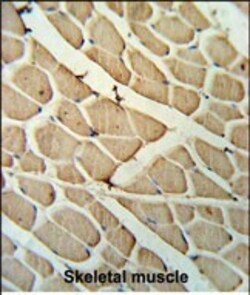 Invitrogen YTHDF3 Polyclonal Antibody 200 &mu;L; Unconjugated:Antibodies,