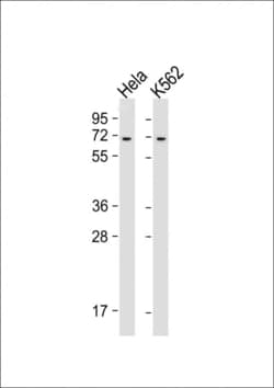 Invitrogen YTHDF3 Polyclonal Antibody 200 &mu;L; Unconjugated:Antibodies,