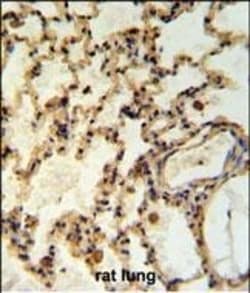 Invitrogen IMMP2L Polyclonal Antibody 400 &mu;L; Unconjugated:Anticuerpos