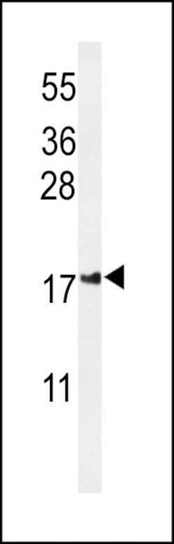 Invitrogen IMMP2L Polyclonal Antibody 400 &mu;L; Unconjugated:Anticuerpos