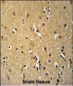 Invitrogen CD30 Polyclonal Antibody 400 &mu;L; Unconjugated:Antibodies,