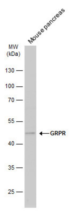 GRPR Polyclonal Antibody, Invitrogen&trade;