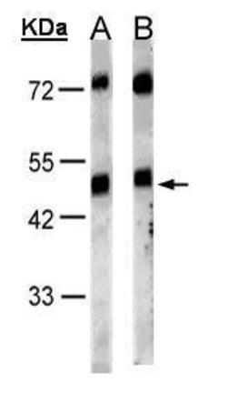 GRPR Polyclonal Antibody, Invitrogen&trade;