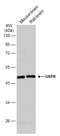 GRPR Polyclonal Antibody, Invitrogen&trade;