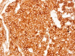 TGR5 Polyclonal Antibody, Invitrogen 100 &mu;L; Unconjugated:Antibodies,