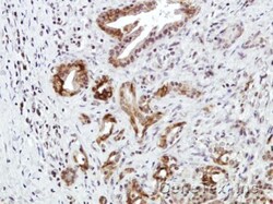 Invitrogen CXCR7 Polyclonal Antibody 100 &mu;L; Unconjugated:Antibodies,