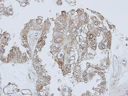 TRHR Polyclonal Antibody, Invitrogen 100 &mu;L; Unconjugated:Antibodies,