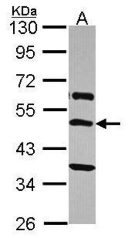 TRHR Polyclonal Antibody, Invitrogen 100 &mu;L; Unconjugated:Antibodies,