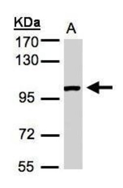 Invitrogen ABR Polyclonal Antibody 100 &mu;L; Unconjugated:Antibodies,