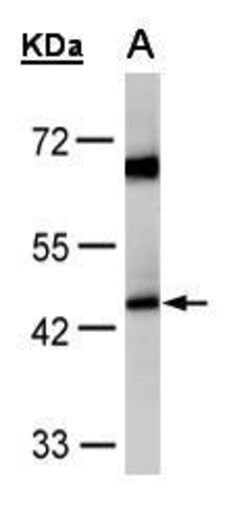 Invitrogen ACADM Polyclonal Antibody 100 &mu;L; Unconjugated:Antibodies,