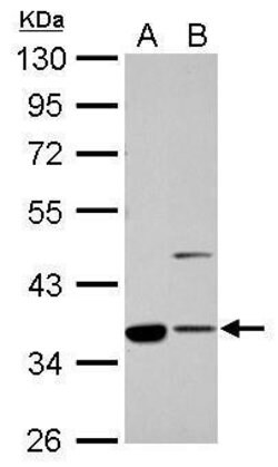 Invitrogen Annexin A2 Polyclonal Antibody 100 &mu;L | Buy Online | Invitrogen&trade; | Fisher Scientific