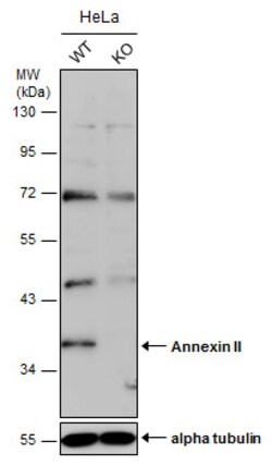 Invitrogen Annexin A2 Polyclonal Antibody 100 &mu;L | Buy Online | Invitrogen&trade; | Fisher Scientific