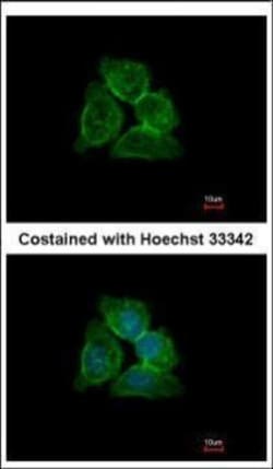 Invitrogen Annexin A13 Polyclonal Antibody 100 &mu;L; Unconjugated:Antibodies,