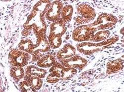 Annexin A13 Polyclonal Antibody, Invitrogen 100 &mu;L; Unconjugated:Antibodies,