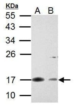 Invitrogen Survivin Polyclonal Antibody 100 &mu;L; Unconjugated:Antibodies,