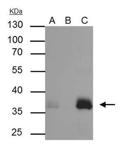 Invitrogen APOE Polyclonal Antibody 100 &mu;L | Buy Online | Invitrogen&trade; | Fisher Scientific