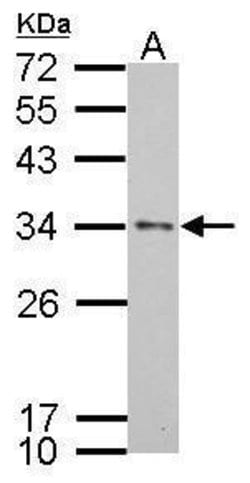 Invitrogen APOE Polyclonal Antibody 100 &mu;L | Buy Online | Invitrogen&trade; | Fisher Scientific