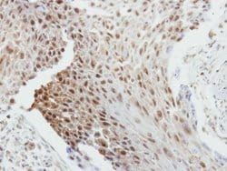 Invitrogen Bcl-2 Polyclonal Antibody 100 &mu;L; Unconjugated:Anticorps,