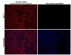 Invitrogen Bcl-2 Polyclonal Antibody 100 &mu;L; Unconjugated:Anticorps,