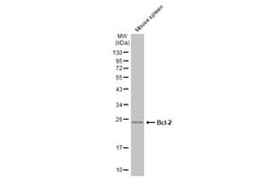Invitrogen Bcl-2 Polyclonal Antibody 100 &mu;L; Unconjugated:Anticorps,