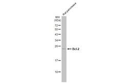 Invitrogen Bcl-2 Polyclonal Antibody 100 &mu;L; Unconjugated:Anticorps,