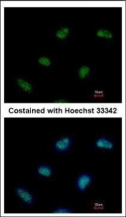 Invitrogen RAD9 Polyclonal Antibody 100 μL; Unconjugated:Antibodies,