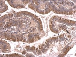 Invitrogen beta Tubulin 2 Polyclonal Antibody 100 &mu;L; Unconjugated:Antibodies,