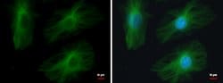 Invitrogen beta Tubulin 2 Polyclonal Antibody 100 &mu;L; Unconjugated:Antibodies,