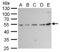 Invitrogen beta Tubulin 2 Polyclonal Antibody 100 &mu;L; Unconjugated:Antibodies,