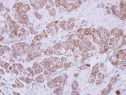 Invitrogen TIP30 Polyclonal Antibody 100 &mu;L; Unconjugated:Antibodies,