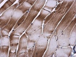 Invitrogen TIP30 Polyclonal Antibody 100 &mu;L; Unconjugated:Antibodies,