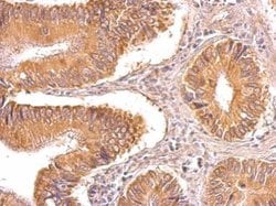 Invitrogen TIP30 Polyclonal Antibody 100 &mu;L; Unconjugated:Antibodies,