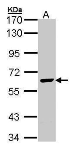 EME1 Polyclonal Antibody, Invitrogen 100 &mu;L; Unconjugated:Antibodies,
