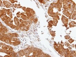 Invitrogen TDP1 Polyclonal Antibody 100 &mu;L; Unconjugated:Antibodies,