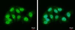 Invitrogen DDB1 Polyclonal Antibody 100 &mu;L; Unconjugated:Antibodies,