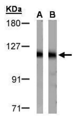 Invitrogen DDB1 Polyclonal Antibody 100 &mu;L; Unconjugated:Antibodies,