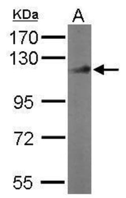 Invitrogen DDB1 Polyclonal Antibody 100 &mu;L; Unconjugated:Antibodies,