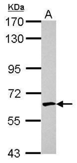 Invitrogen EME1 Polyclonal Antibody 100 &mu;L; Unconjugated:Antibodies,