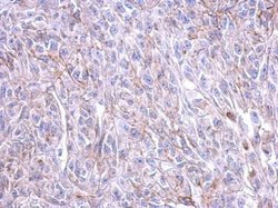 CRHR1 Polyclonal Antibody, Invitrogen 100 &mu;L; Unconjugated:Antibodies,